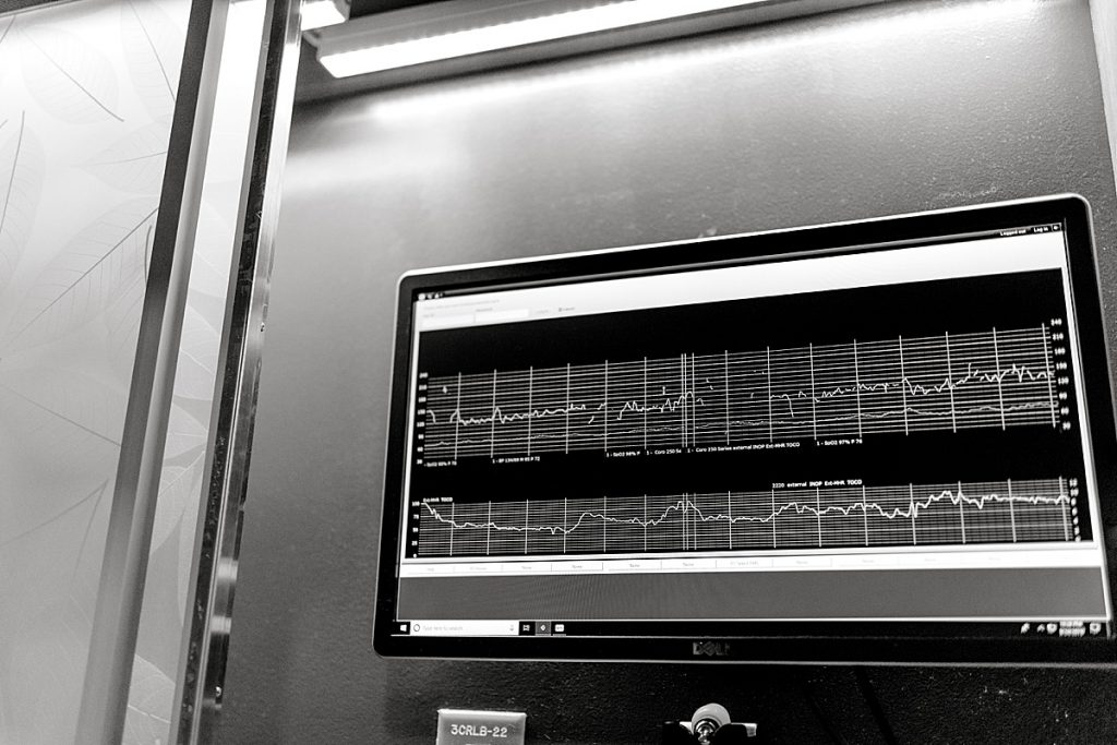 EKG machine at Texas Health Presbyterian Hospital