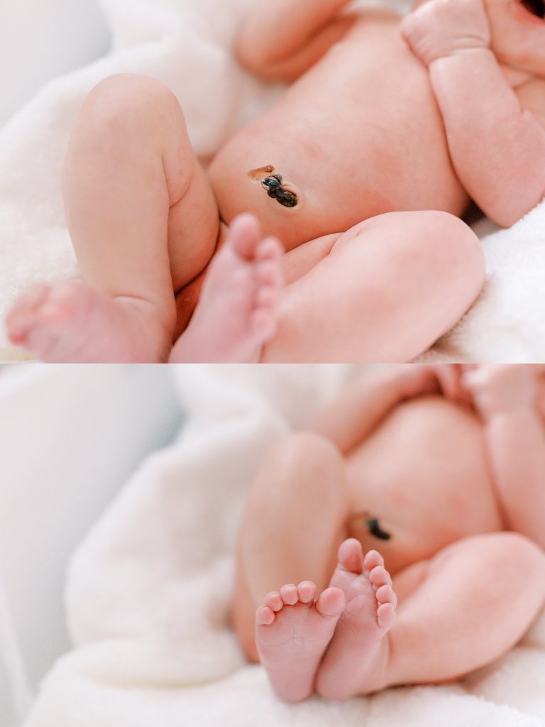 Newborn baby feet newborn cut umbilical